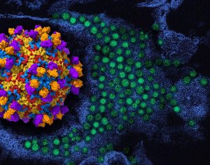 debut-d’un-essai-therapeutique-parraine-par-le-nih-sur-l’enterovirus-d68