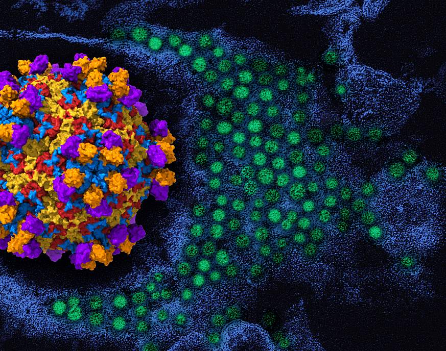 debut-d’un-essai-therapeutique-parraine-par-le-nih-sur-l’enterovirus-d68