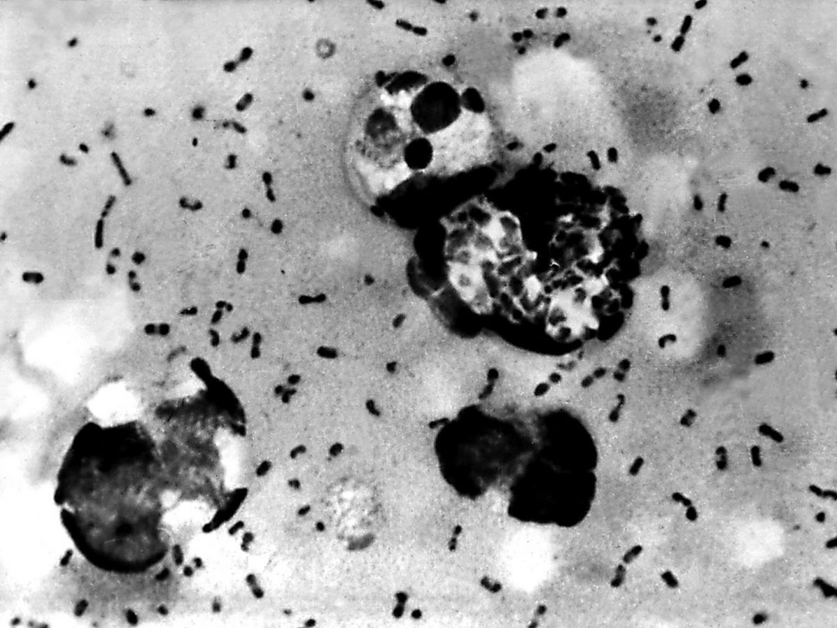 cases of plague in the united states: should we be worried?