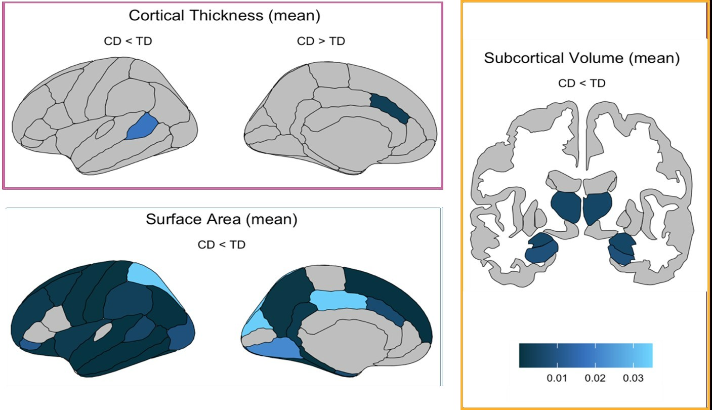 la-structure-cerebrale-des-jeunes-atteints-de-troubles-des-conduites-montre-des-differences-cerebrales-generalisees