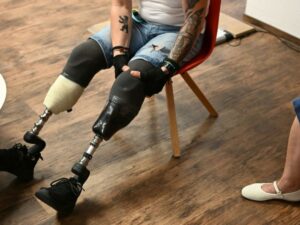 Ukrainian amputees learn to walk again with German prosthetics