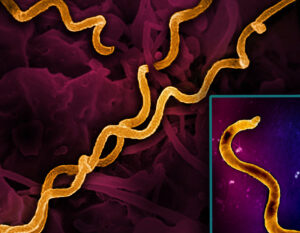 NIH grants will support innovation in syphilis diagnosis