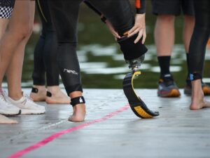 make-a-new-skin-to-better-support-prostheses-?