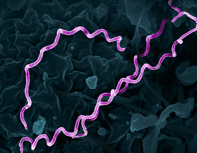 the-rate-of-detection-of-syphilis-in-the-emergency-room-is-more-than-twice-higher