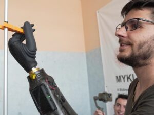 the-world's-first-magnetic-hand-prosthesis