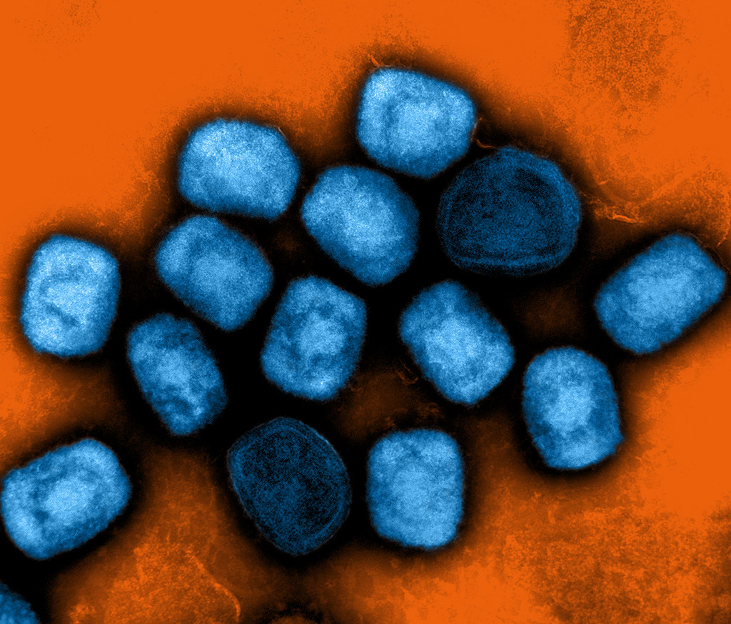 NIH publishes its MPOX research program