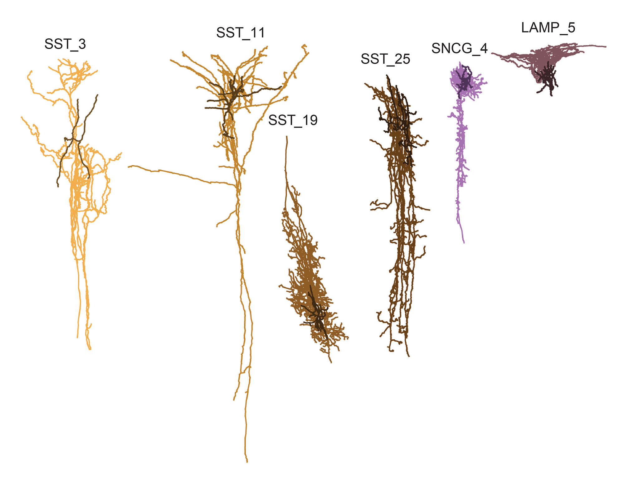 la-maladie-d’alzheimer-peut-affecter-le-cerveau-par-phases