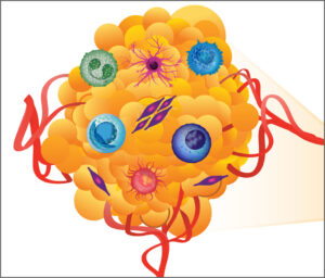 des-scientifiques-finances-par-le-nih-decouvrent-des-indices-sur-la-biologie-du-precancer-et-des-tumeurs