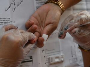 HIV and AIDS: Little by little, the situation is improving