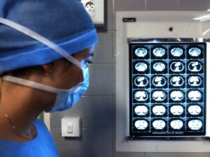 premature-aging-of-one-organ-can-drag-others-down-with-it