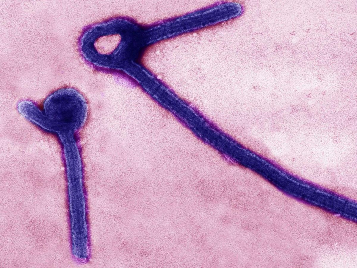 ebola-:-un-simple-contact-avec-la-peau-suffit-a-transmettre-le-virus