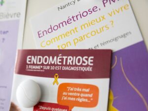 saliva test for endometriosis tested in 20 new hospitals