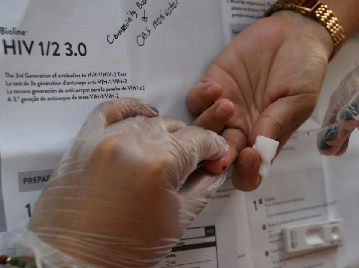The United States approves a very promising preventive treatment for HIV