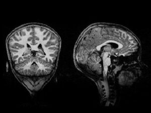 cerveau-de-l’enfant-:-des-images-d’une-precision-inedite-obtenues-par-des-chercheurs-francais