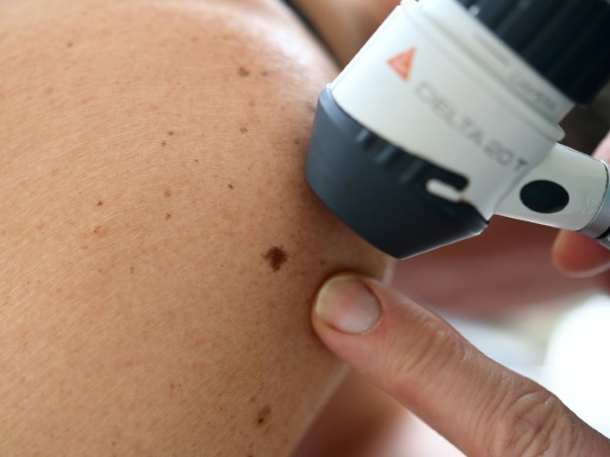 les-dermatologues-a-fleur-de-peau-sur-la-question-de-leurs-effectifs