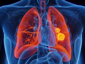 des-transfusions-de-mitochondries-pour-lutter-contre-le-cancer