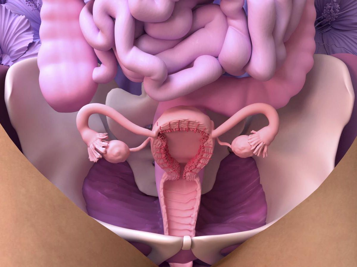 sans-uterus-ni-ovaires,-le-risque-d’avc-augmente