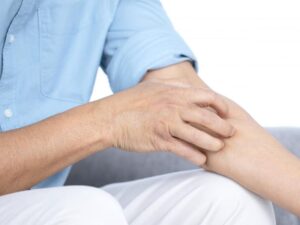 eczema-:-la-surprenante-force-d’adhesion-du-staphylocoque-dore