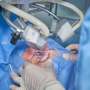 Cataract surgery on both eyes can be carried out safely and effectively in one go, studies indicate