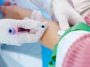 maladie-d’alzheimer-:-un-test-sanguin-facilite-le-diagnostic