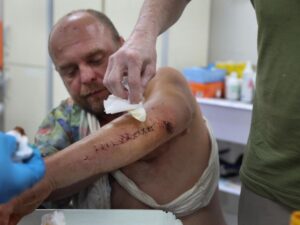 pour-soigner-une-blessure,-les-cellules-sont-capables-de-rajeunir-tres-rapidement