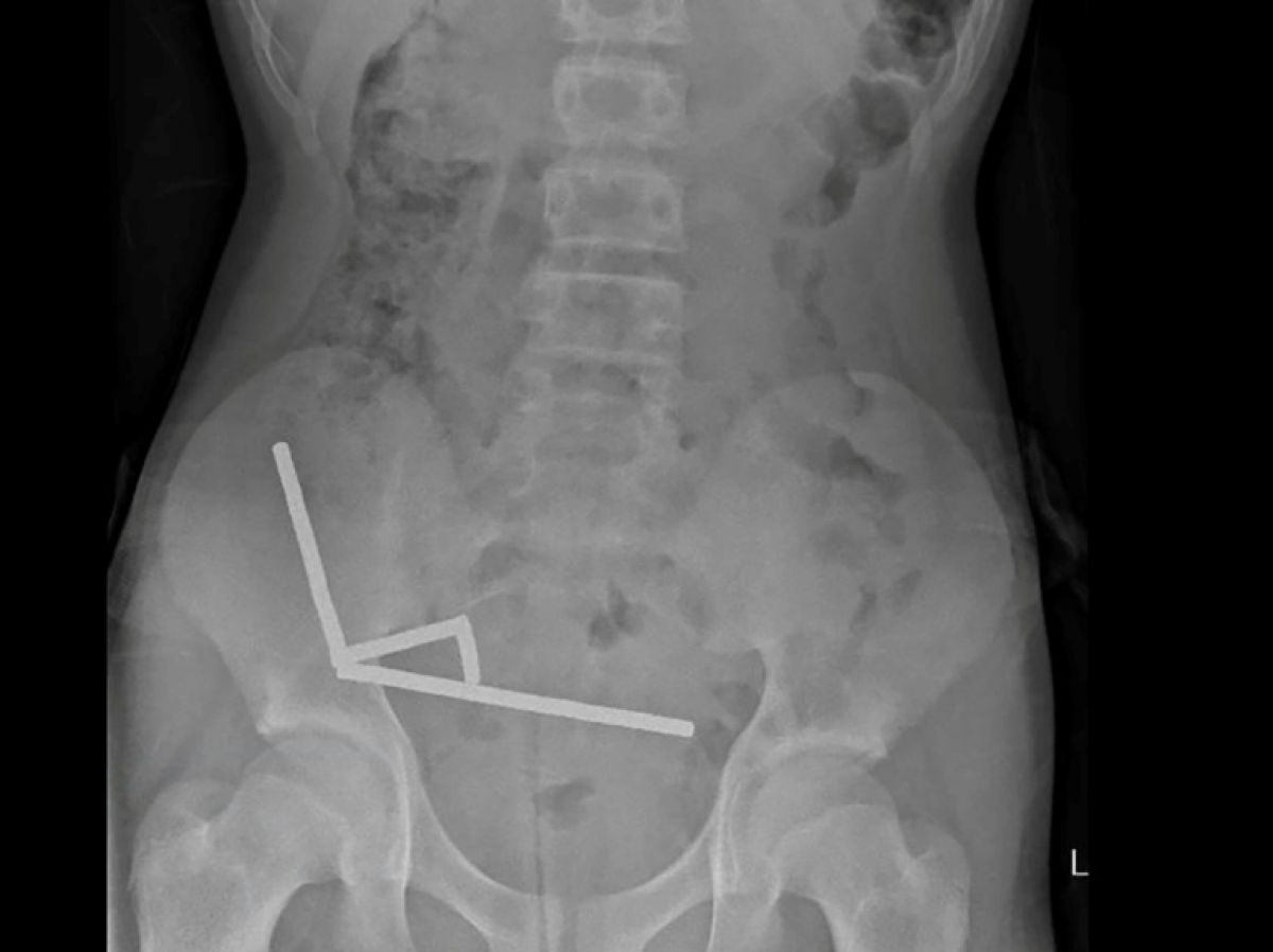 un-adolescent-opere-apres-avoir-ingere-pres-de-100-aimants-achetes-sur-temu