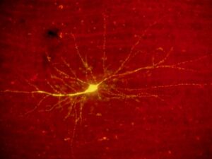 memory: an epigenetic switch that activates or deactivates a memory