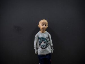a gene for centenarians against progeria