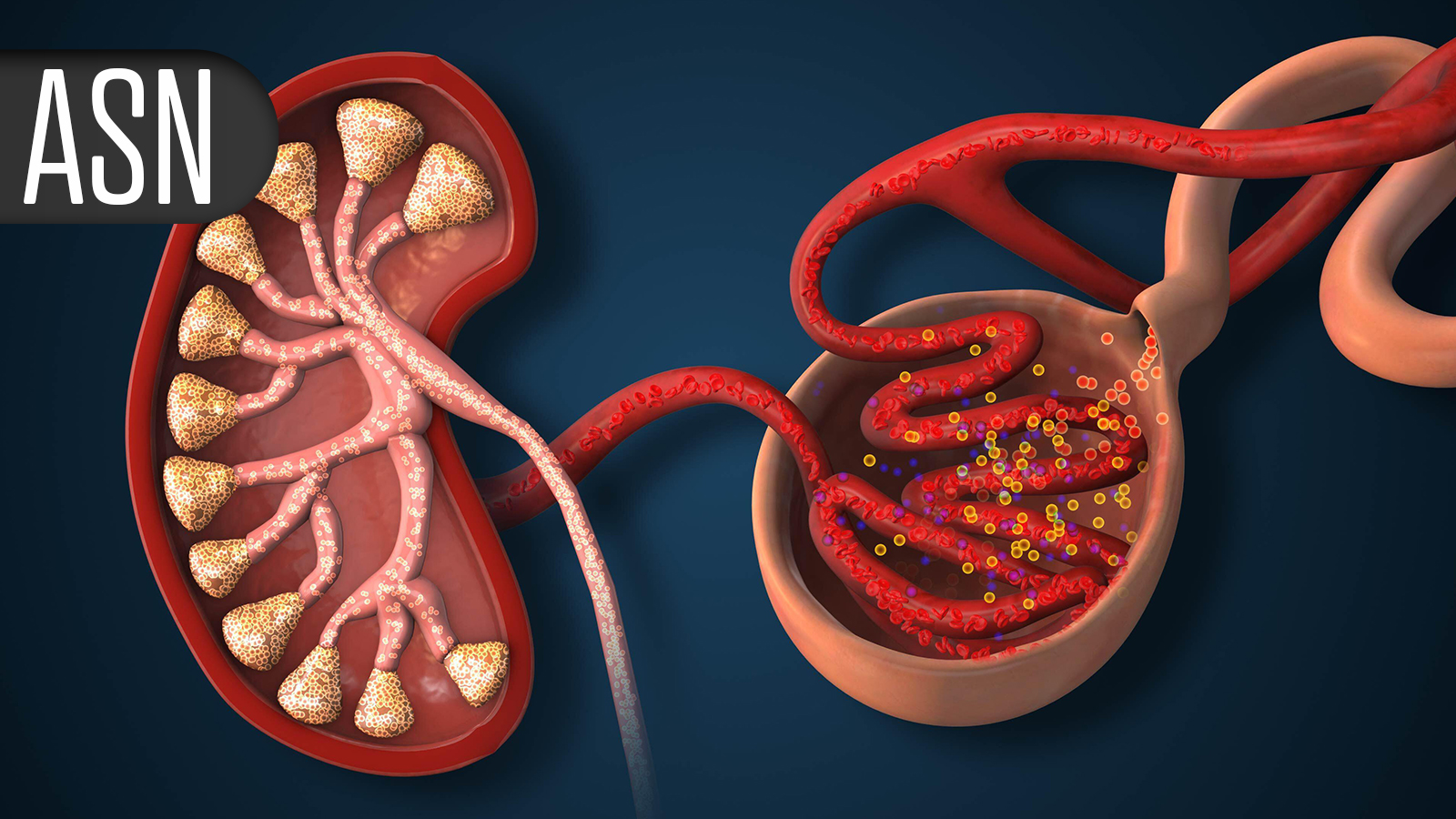 Culturally Tailored Approach Helps Latinos in Kidney Failure
