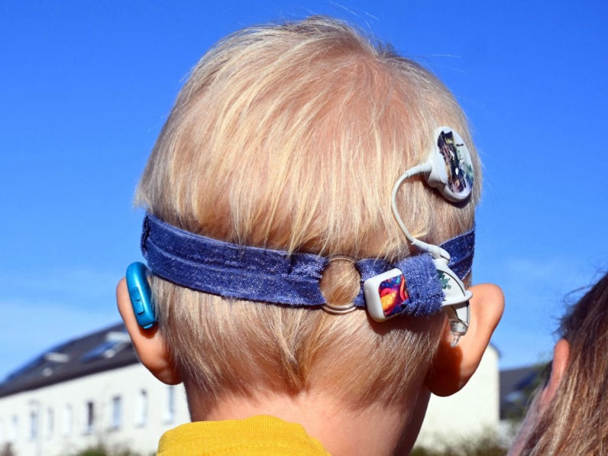 surdite :-l’implant-cochleaire,-une-solution-« miracle »-?