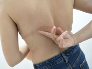 en-andalousie,-la-detresse-de-femmes-atteintes-de-cancer-du-sein,-« oubliees »-du-systeme-de-sante