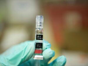 In the United States, the vaccination of newborns against hepatitis B is under scrutiny.