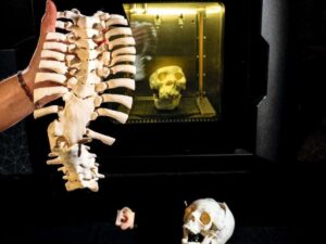 hospital: 3D printing for precision medicine