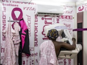 Breast cancer: AI improves human screening, says a large Swedish study