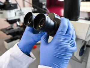 Rise in colorectal cancer among those under 50: causes still mysterious