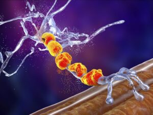 Charcot's disease: shedding light on the origin of toxic proteins