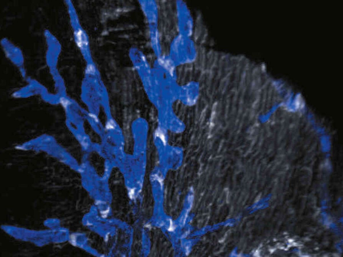 heart-:-unknown-valves-in-the-lymphatic-system