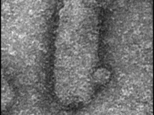 "Viral Trojan horse": viruses travel inside other viruses