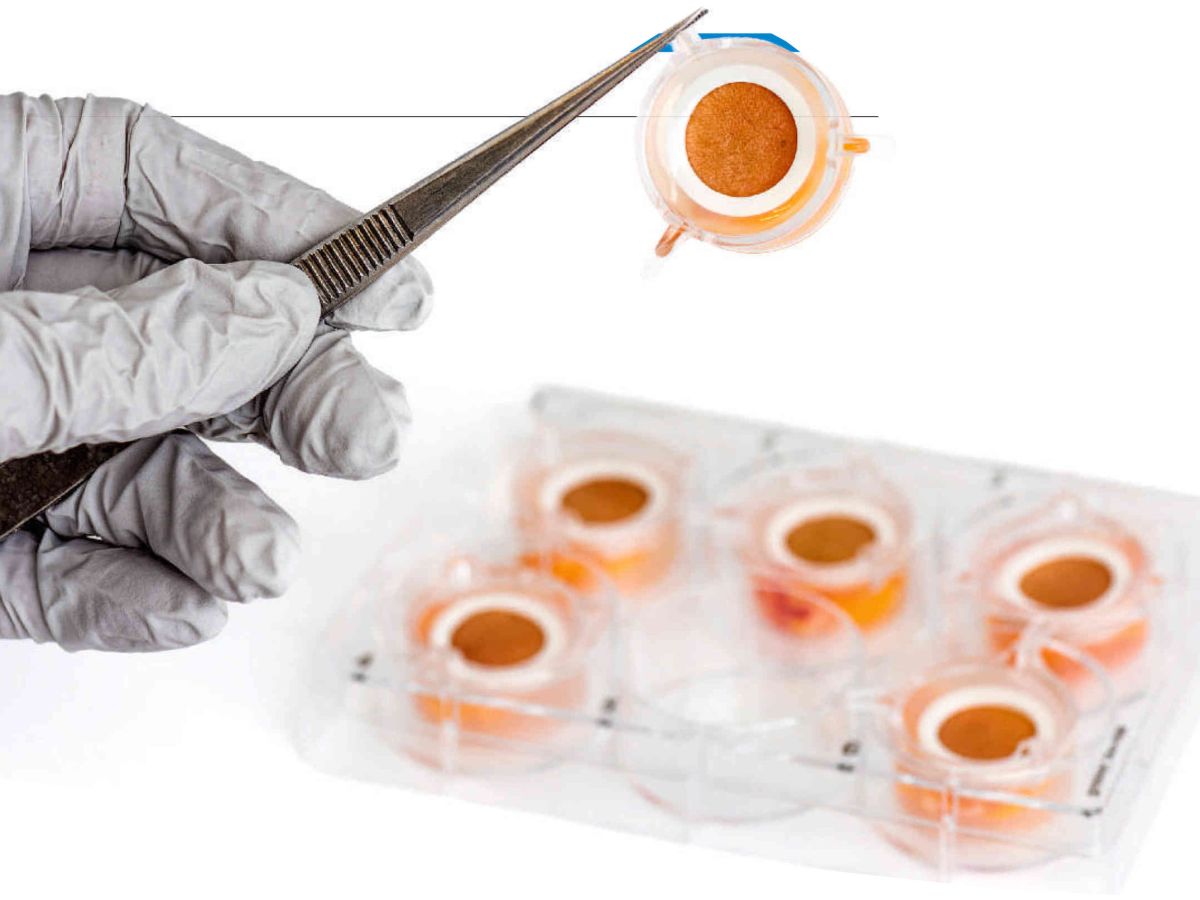 donner-une-seconde-vie-a-la-peau