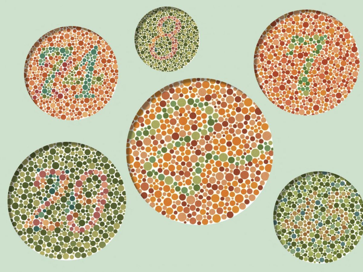 color blindness worsens the prognosis of bladder cancer