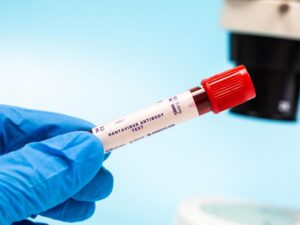 What is a hantavirus?