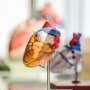 Study finds no benefit to miniature heart pump during complex stent procedures