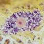 Macrophage 'molecular scissors' may drive obesity-linked inflammation and metabolic damage