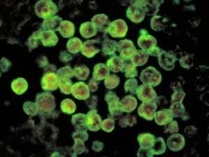 claustrophilia in "brain-eating" amoebas«