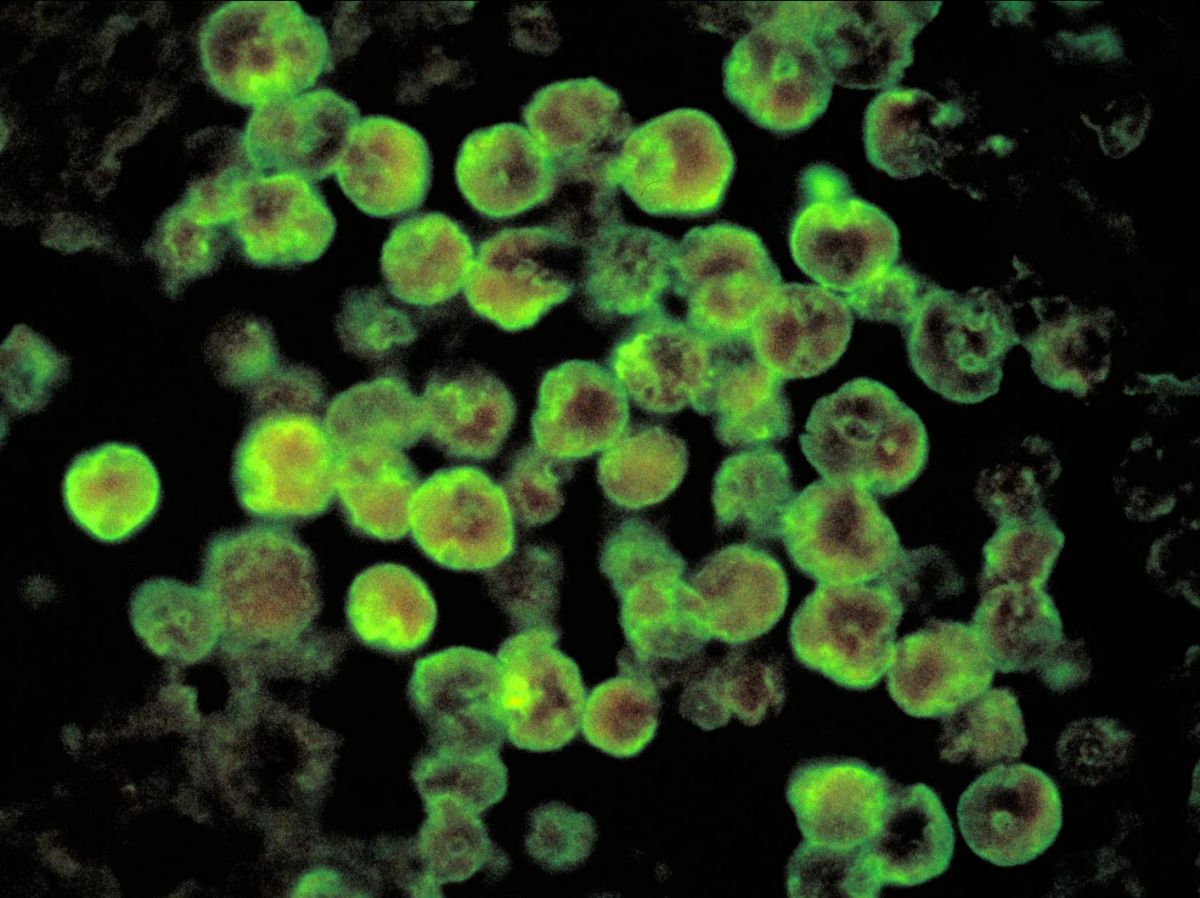 la-claustrophilie-des-amibes-« mangeuses-de-cerveau »