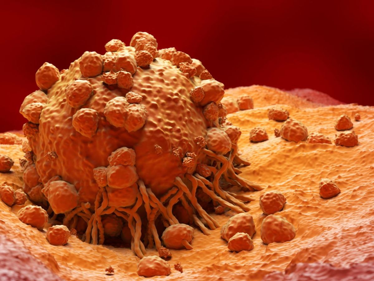 cancer-:-comment-la-tumeur-berne-le-systeme-immunitaire