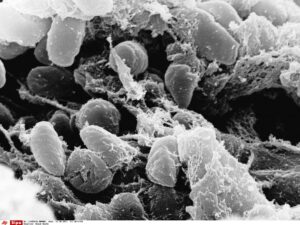 Suspected plague in Russia: Tests of contacts come back negative