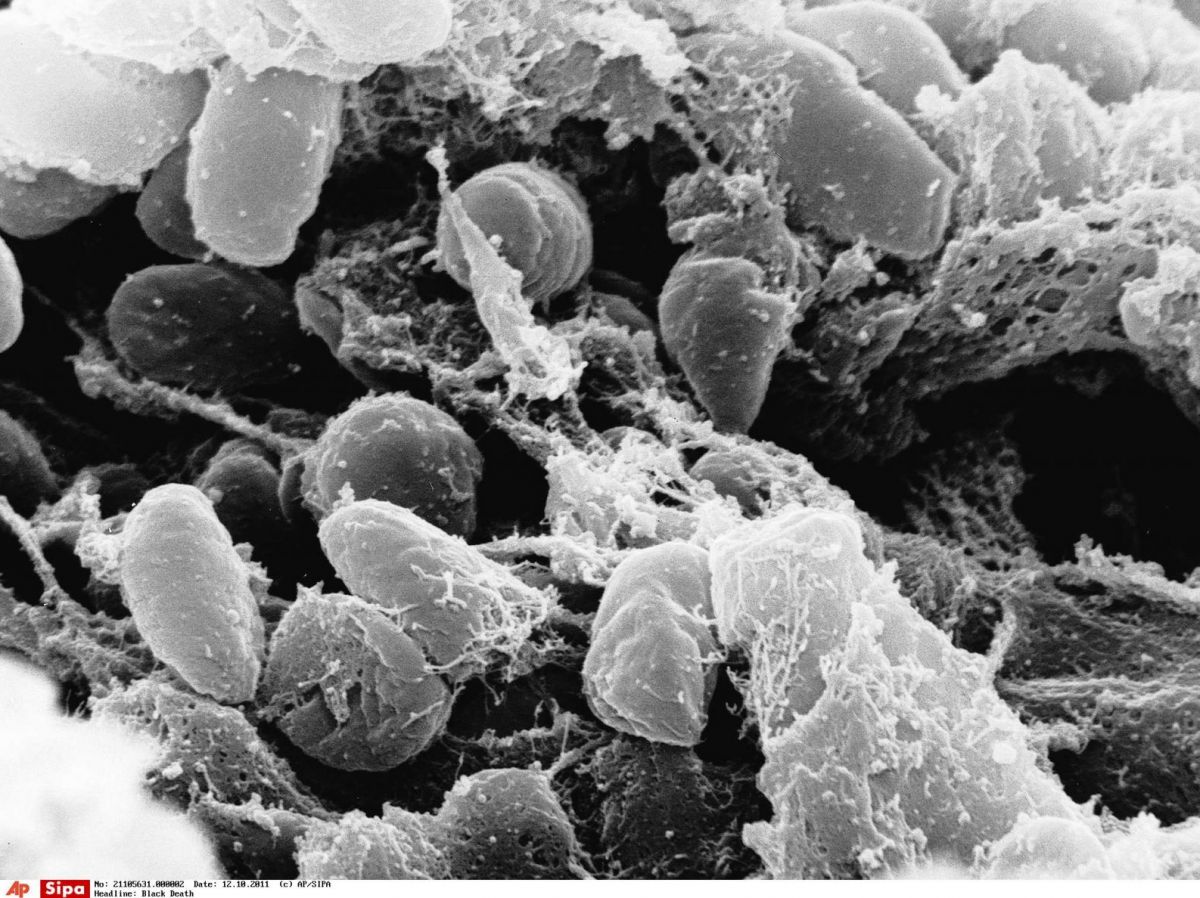 Suspected plague in Russia: Tests of contacts come back negative