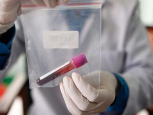 a blood test to detect high-risk type 2 diabetes