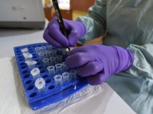 au-nigeria,-le-« choc »-apres-l&rsquo;annonce-d&rsquo;un-premier-cas-d&rsquo;ebola-bundibugyo